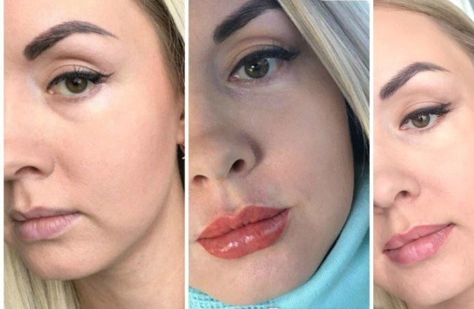 Fotografii înainte și după tatuajul buzelor