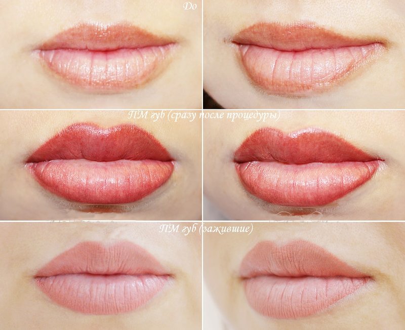 Photos avant et après le tatouage des lèvres