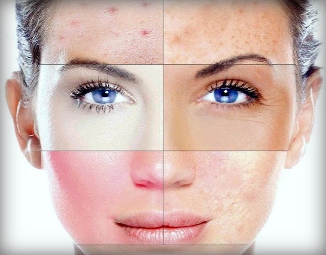 Maske for forskjellige hudtyper