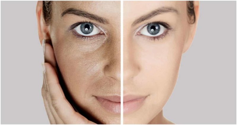 Visage avant et après l'utilisation d'un masque à l'huile de coco