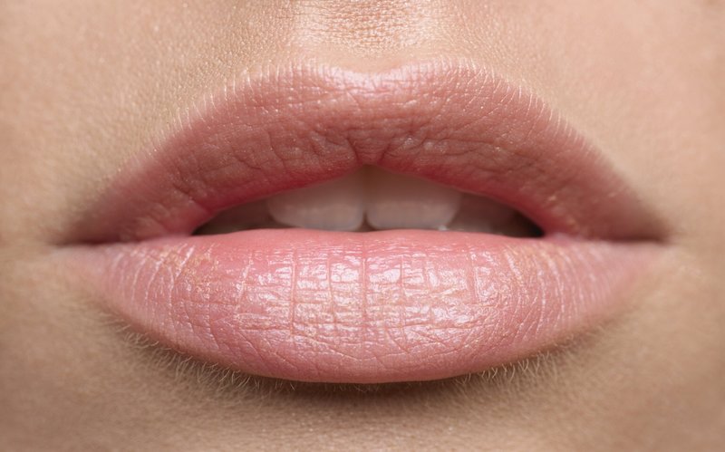 Forme de lèvre classique