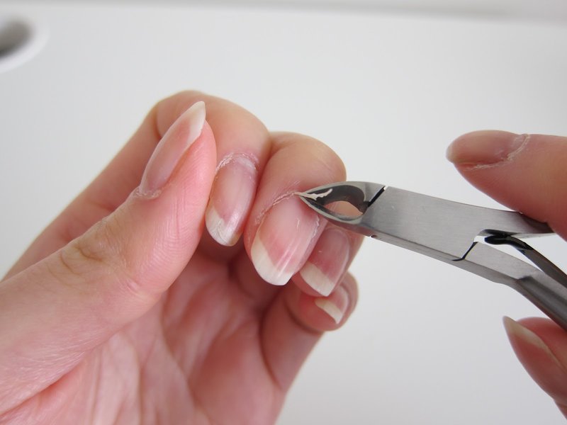 Thuis verwijderen van nagelriemen