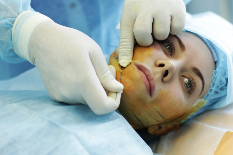 Möjliga komplikationer och konsekvenser av ansiktslyftning med mesothreads